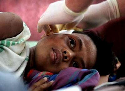 A wounded girl receives treatment